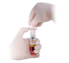 Plasma Rich Protein isolation